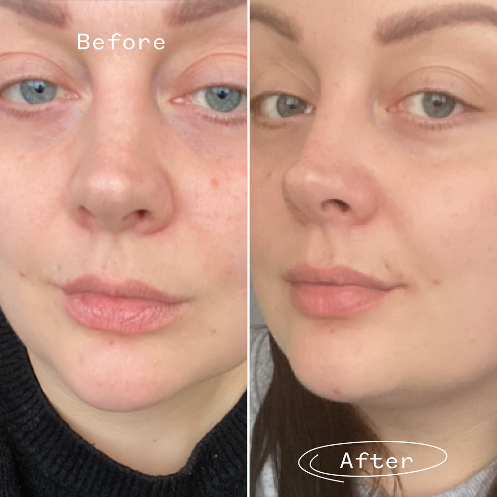 Rosehip Bioregenerate Face Oil 30ml
